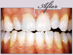 new york cosmetic dentist